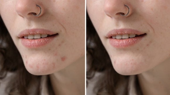 Close up picture of face with touch up tools applied